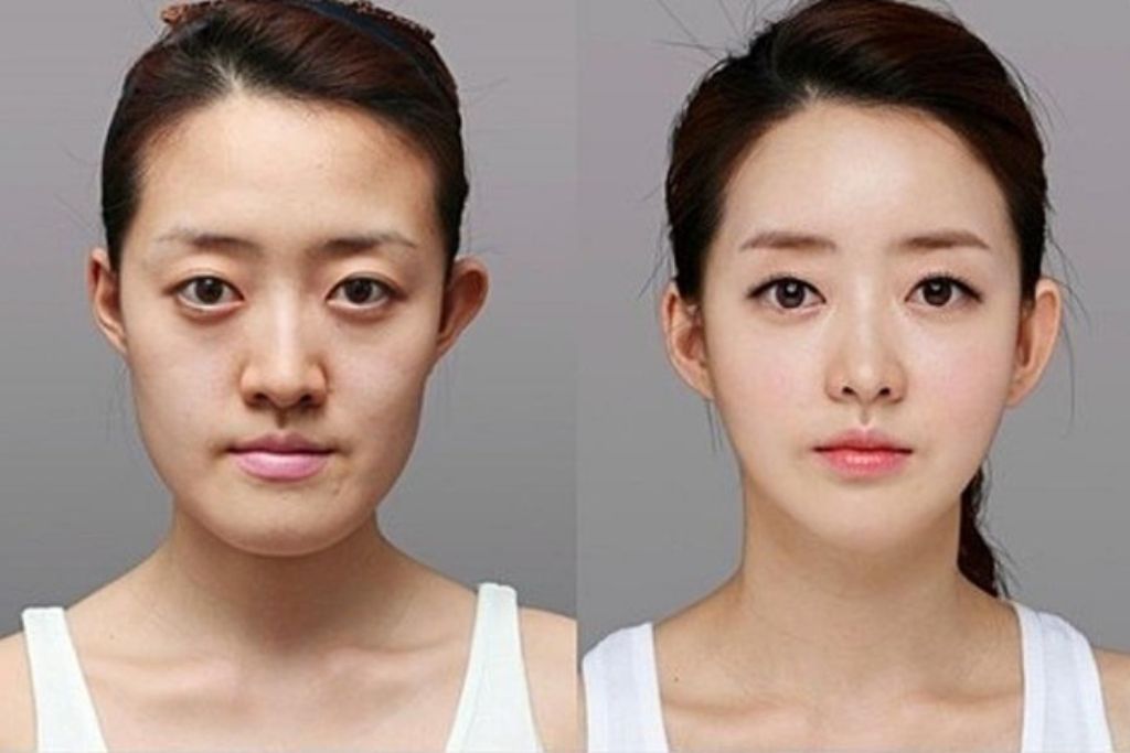 Thẩm mỹ Á - Âu - Thẩm mỹ viện ở TPHCM nổi tiếng